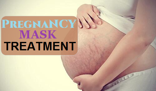 Best Pregnancy Mask Treatment Secrets