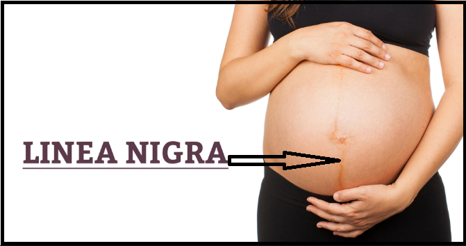 SKIN CARE FOR PREGNANT WOMEN-Do This And Live A Happy Pregnant Life.